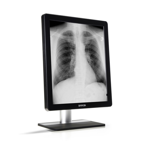 Monitor de Diagnótico para Mamografia Coronis 5MP MDCG-5221 Barco - Konimagem
